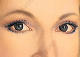 cost eyelid surgery abroad