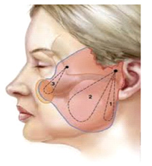 facial fat grafting tunisia