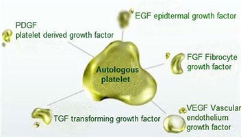 platelet rich plasma tunisia