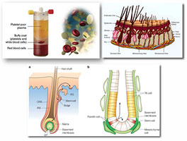 prp hair loss tunisia