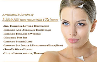 vampire facelift tunisia